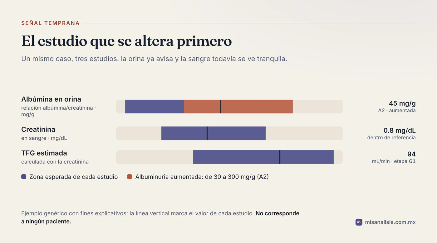 Tres pistas de un mismo caso: la albúmina en orina en 45 mg/g queda fuera de la zona esperada, mientras la creatinina de 0.8 mg/dL y la TFG de 94 siguen dentro.