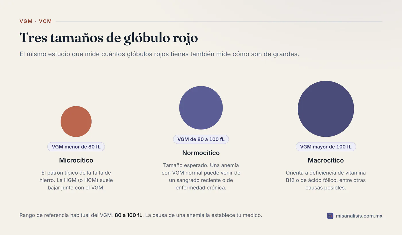 Tres círculos de distinto tamaño que representan glóbulos rojos microcíticos con VGM menor de 80 fL, normocíticos de 80 a 100 fL y macrocíticos por arriba de 100 fL.